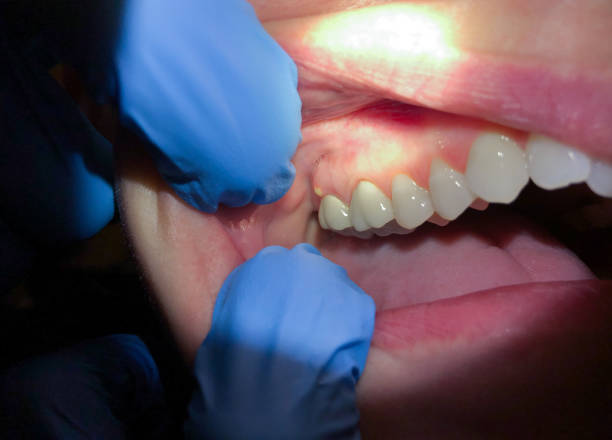 Best Walk-In Emergency Dentist in Ashton Sandy Spring, MD